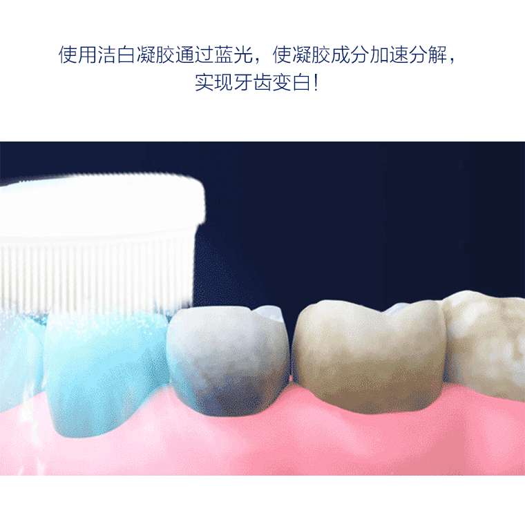 蓝光洁牙仪,洁白清洗二合一