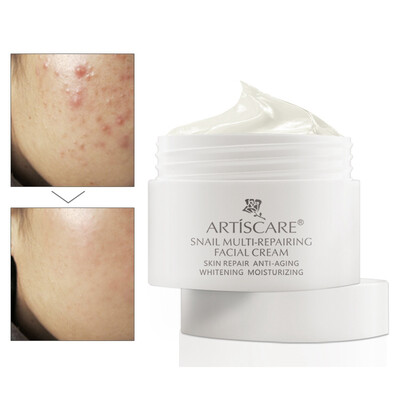 Pure Natural Snail Repair Facial Cream Oil-Control Anti-Wrinkle Acne Moisturizing Lifting Skin Care Easy To Absorb
Pure Natural Snail Repair Facial Cream Oil-Control Anti-Wrinkle Acne Moisturizing Lifting Skin Care Easy To Absorb