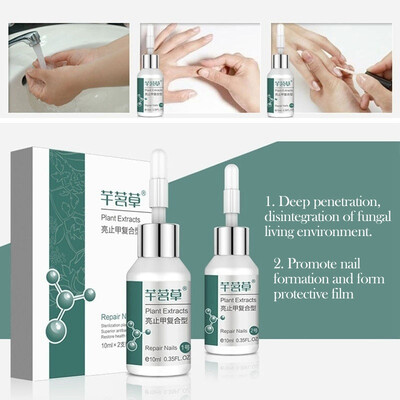 Anti-Fungal Nail Treatment Liquid Anti-fungal Plant Extracts Onychomycosis And Paronychia Repair Liquid Nail Protector
Anti-Fungal Nail Treatment Liquid Anti-fungal Plant Extracts Onychomycosis And Paronychia Repair Liquid Nail Protector