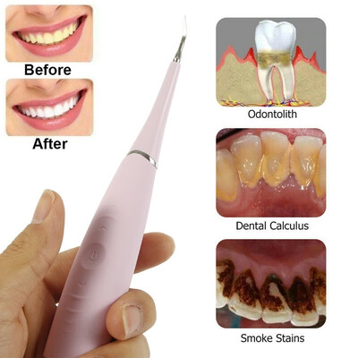 Electric Tooth Plaque Removal Calculus Plaque Removal Tool Tooth Stain Scraper Tartar Removal Cleaner Tooth Whitening Tool
Electric Tooth Plaque Removal Calculus Plaque Removal Tool Tooth Stain Scraper Tartar Removal Cleaner Tooth Whitening Tool