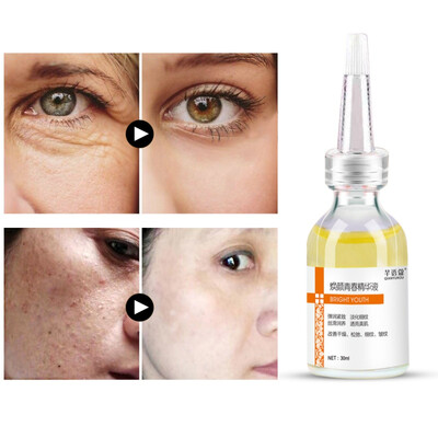 30 ml Whitening Blemish Mosturizing Anti-acne Essence Hyaluronic Acid Liquid Plant Extract Face Serum
30 ml Whitening Blemish Mosturizing Anti-acne Essence Hyaluronic Acid Liquid Plant Extract Face Serum