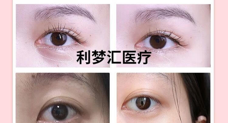 5c7d82a9021ba5e5.jpg