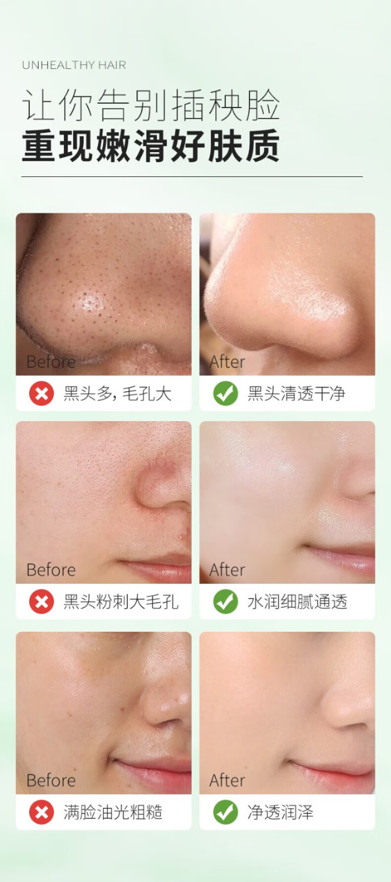 MAIGOOLE清洁泥膜面膜泥去角质黑头控油收缩细致毛孔绿茶敏感肌面膜女士 深层清结 一瓶装