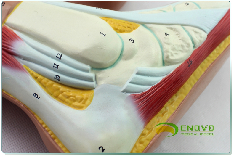 enovo颐诺正常足扁平足弓形足高弓足模型脚足弓模型医学教学用运动