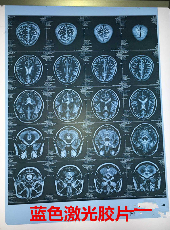 新型蓝基高清医院用胶片drcrctx光mr磁共振蓝色喷墨胶片1214