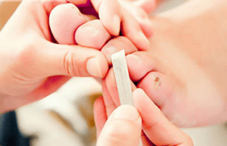  足部护理妙招