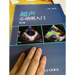超声心动图