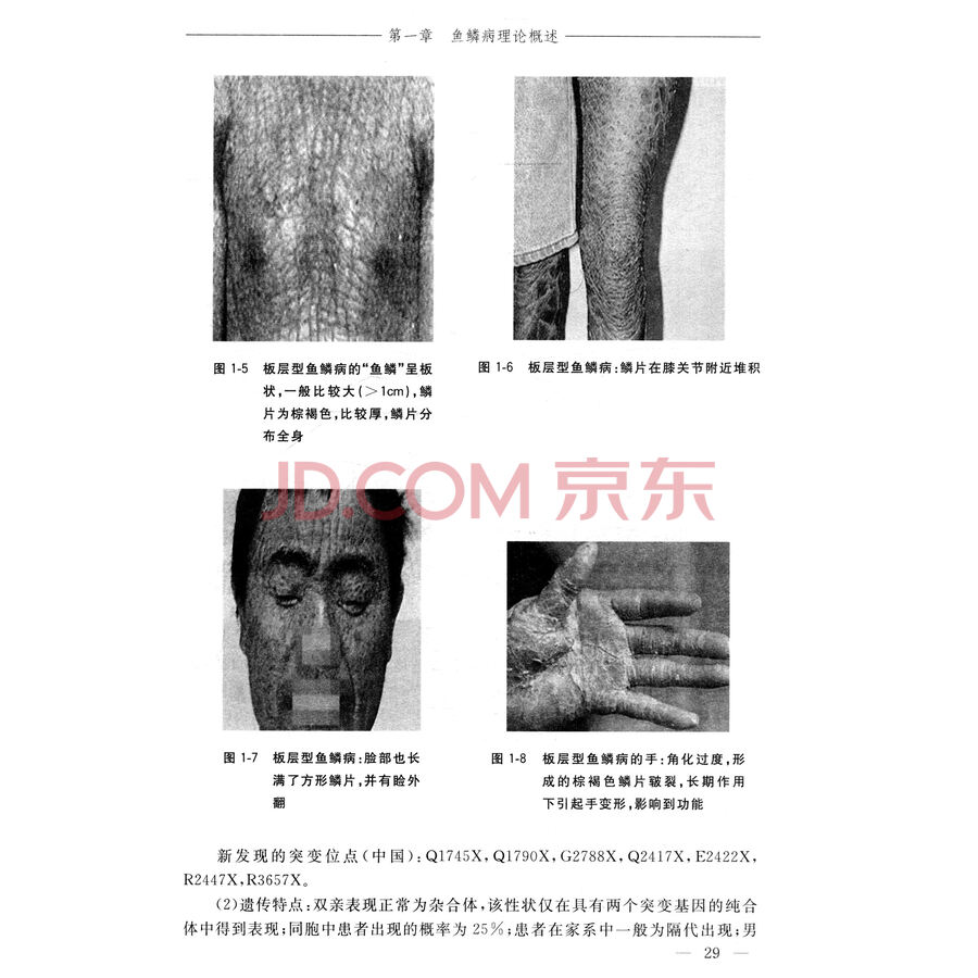 名中医张建治疗鱼鳞病