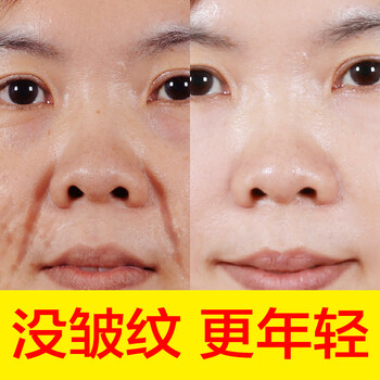 去除,怎么樣,去除,法令,法令