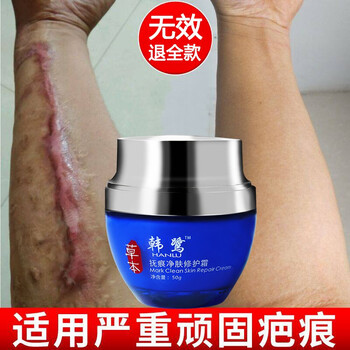 產(chǎn)品,男士,產(chǎn)品,祛疤,祛疤,男士,怎么樣
