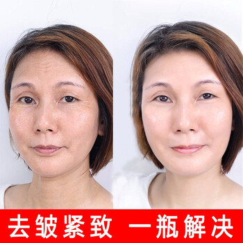 青春抗衰