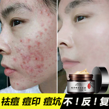 美主人乳液/面霜細(xì)致毛孔，舒緩鎮(zhèn)靜，修護(hù)，抗痘