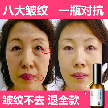 皺紋精華液