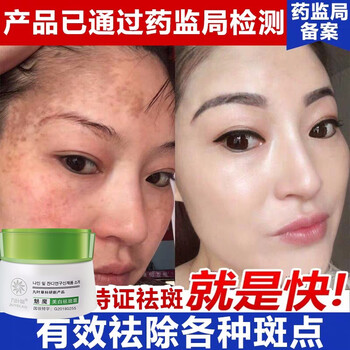 去黃褐斑面霜