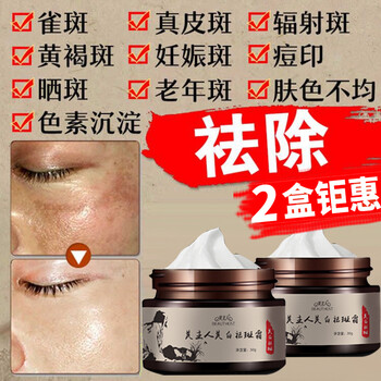 美白祛斑霜推薦