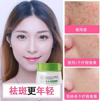 去黃美白精華