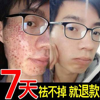 痘疤毛孔