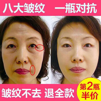 九葉草 面部精華 美白，控油平衡，細(xì)致毛孔，提亮，舒緩鎮(zhèn)靜，抗衰，抗皺，提拉緊致，保濕，抗氧化，補(bǔ)水