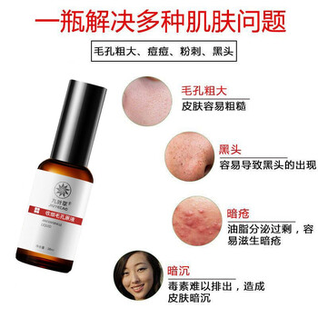 毛孔粗大修復