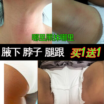 去沉淀色素