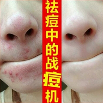 肌膚之食（skinmenu） 面部精華 美白，抗皺，修護(hù)，淡斑，抗痘