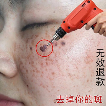 美白去雀斑的產(chǎn)品