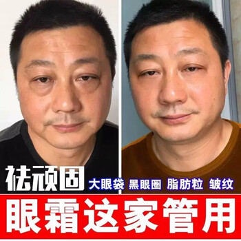 萊蔻（LAIKOU）眼霜/眼部精華 16-30g/mL