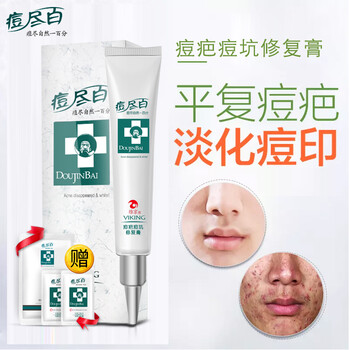 維京乳液/面霜抗痘