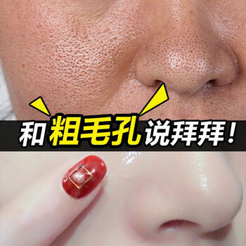 九葉草緊膚水 30ml