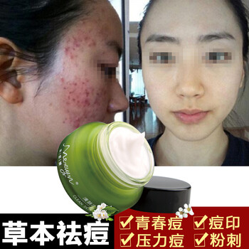 快速,快速,痘痕,痘痕,怎么樣