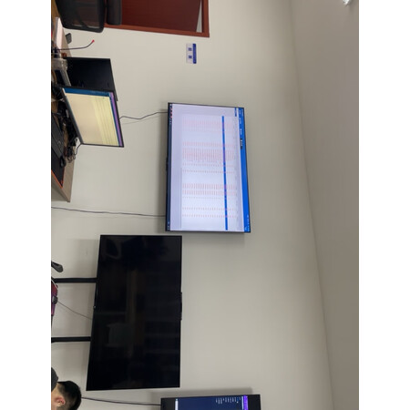 开箱曝光小米电视5pro65和红米x65有什么区别？哪款好用？图文剖析真相