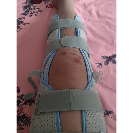 上手评测麦德威（medwe）养生器械如何怎么样，口碑反馈曝光