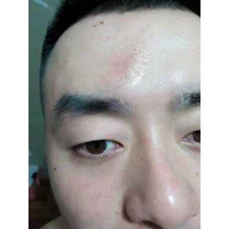 说说评测体验葆顺堂（Baoshuntang）医用疤痕护理性价比高吗，达人分析评测