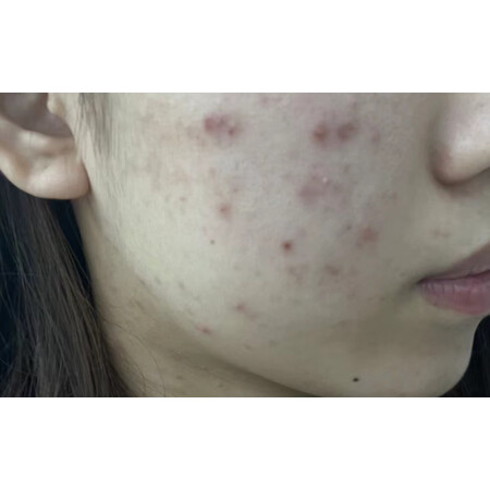 入手使用说说美洳乳液/面霜性价比高不高呢，真实体验诉说