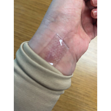 深入解密仙卡硅酮凝胶敷料+自粘性硅酮胶片敷料质量反馈如何，老铁吐露实情