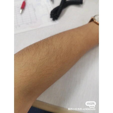 beautigo脱毛仪和ulike哪款好一些_http://www.meifudie.com_好物_第5张