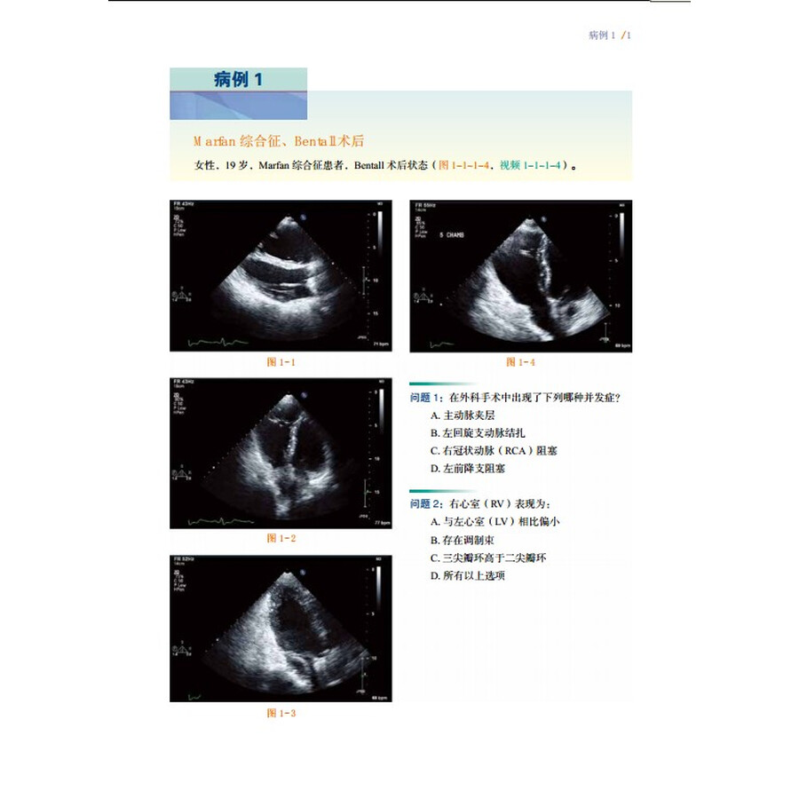 内容简介      《超声心动图典型病例荟萃》由美国cedars sinai 医学