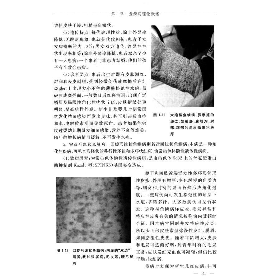 名中医张建治疗鱼鳞病