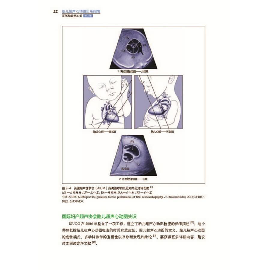 医学 医疗器械及使用 胎儿超声心动图实用指南:正常和异常心脏(第3版)