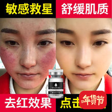 肌膚之食（skinmenu） 面部精華 修護(hù)，抗痘