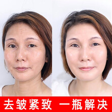 青春抗衰