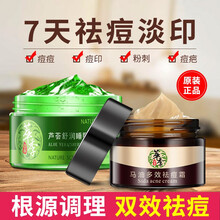 蘆薈膠去痘坑