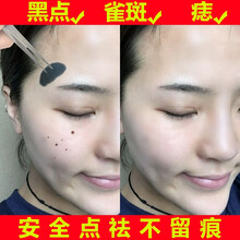 bidailanka 20ml