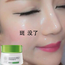去妊娠斑