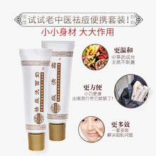 祛粉刺藥膏
