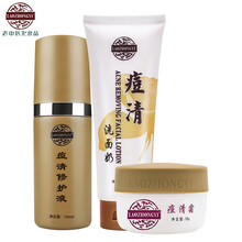 男士專業(yè)祛痘產(chǎn)品