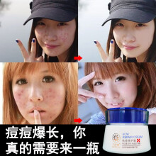 怎么樣,痘印,痘印,粉刺,粉刺,精華,精華