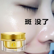 去斑黃褐斑