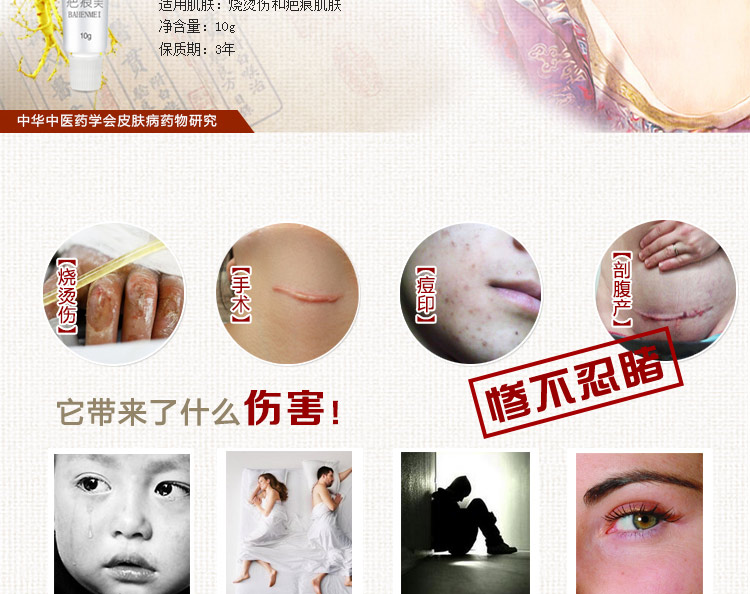 柯医师 疤痕美 10g 烧伤烫伤手术疤痕 增生性疤