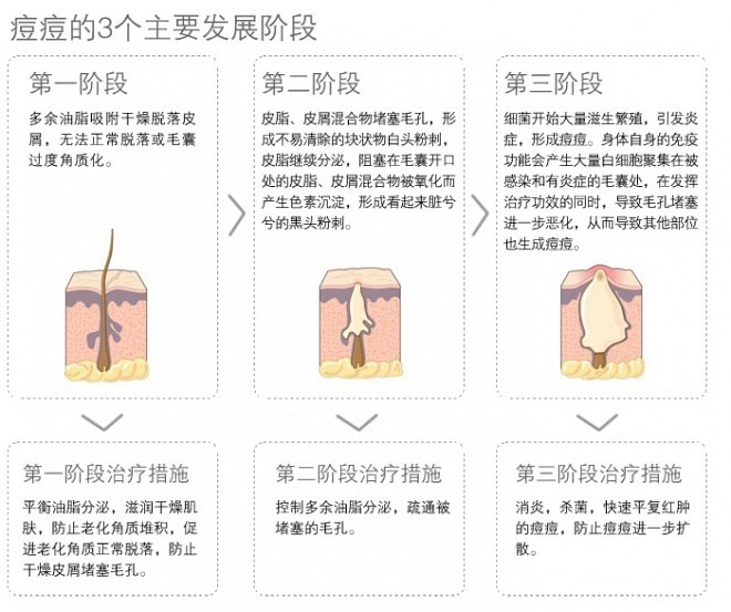 暗疮针使用图解-75KB